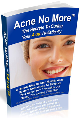 cover of a woman on the book of Acne no More